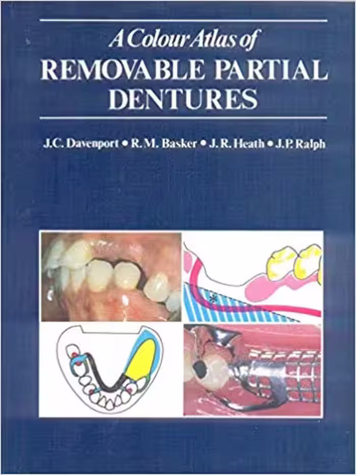 󾕇 دانلود کتاب A Colour Atlas Of Removable Partial Dentures, 1987 - دانلود کتاب های دانشگاهی