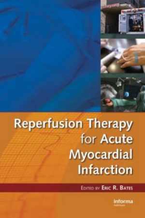 [PDF] دانلود کتاب Reperfusion Therapy For Acute Myocardial Infarction, 2008