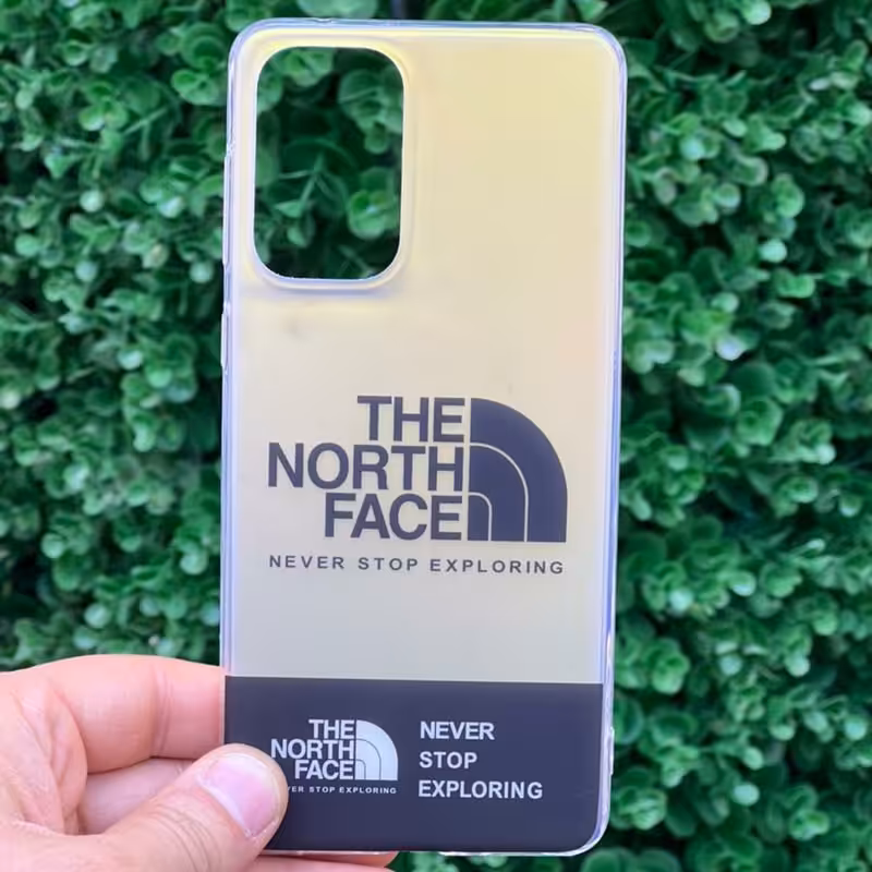 گارد گوشی هولوگرامی گوشی های سامسونگ و شیاومی