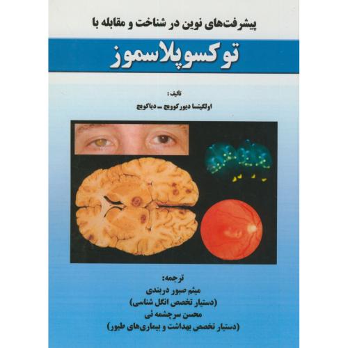 کتاب پیشرفت های نوین در شناخت و مقابله با توکسوپلاسموز