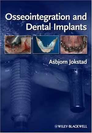 [PDF] دانلود کتاب Osseointegration And Dental Implants, 2009