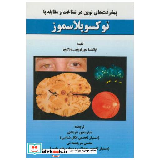 کتاب پیشرفت های نوین در شناخت و مقابله با توکسوپلاسموز اثر اولگیتسا دیور کوویچ