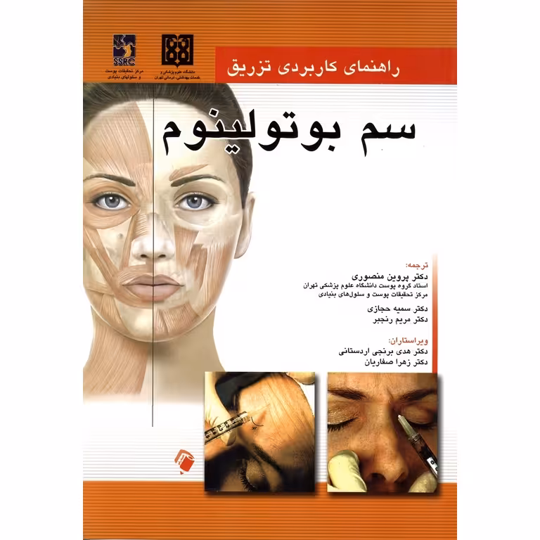 راهنمای کاربردی تزریق سم بوتولینوم