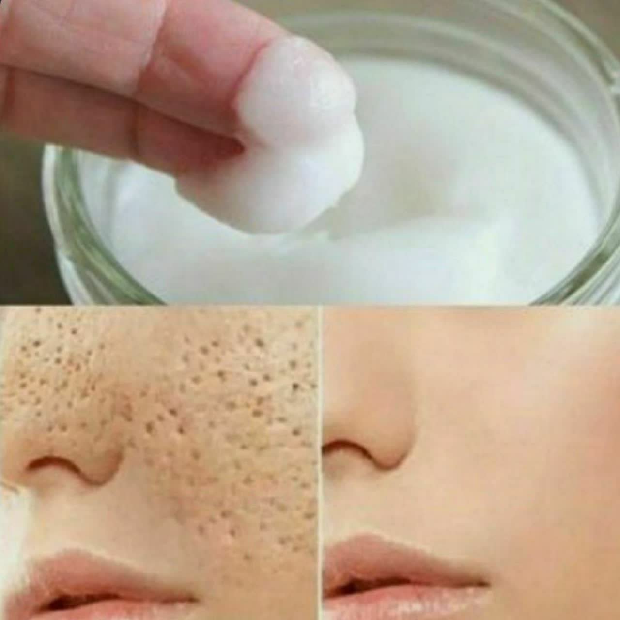 پک منافذ صورت