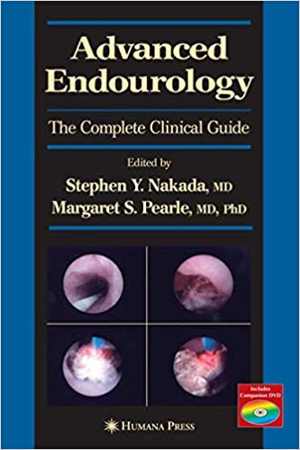 [PDF] دانلود کتاب Advanced Endourology - The Complete Clinical Guide, 2006