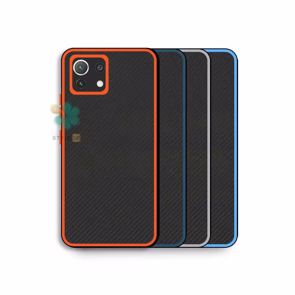 قاب گوشی Magic Eye مناسب شیائومی Mi 11 Lite / 5G