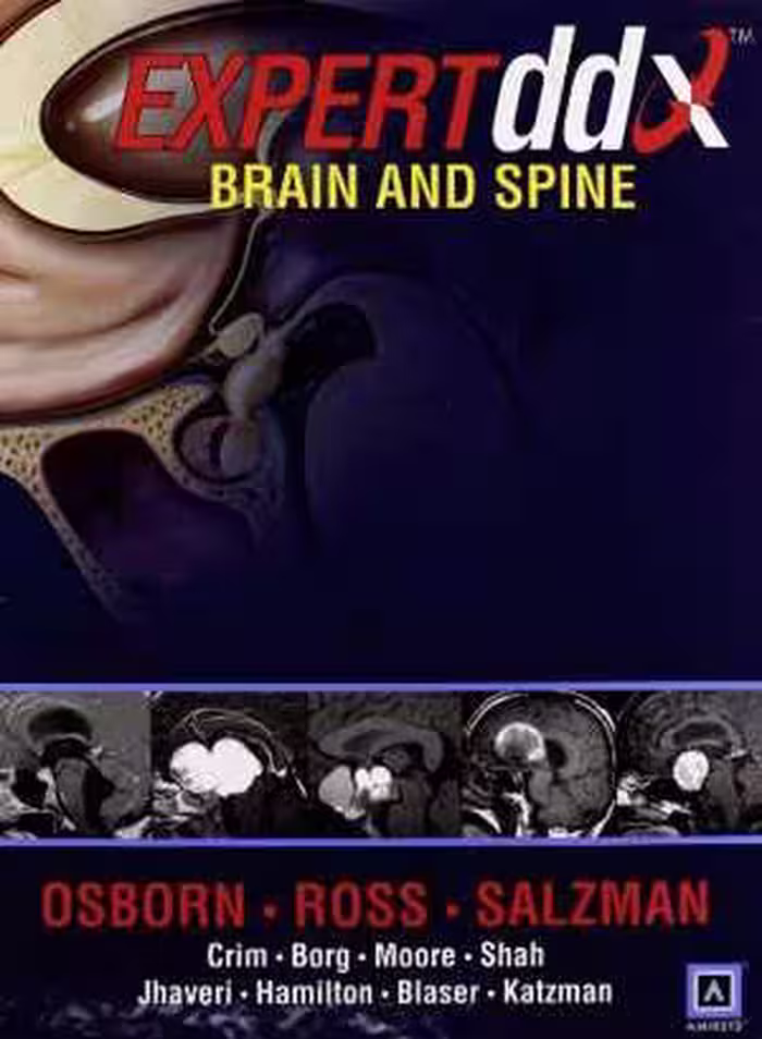 [PDF] دانلود کتاب Expertddx - Brain And Spine, 2008