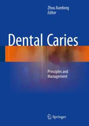 [PDF] دانلود کتاب Dental Caries - Principles And Management, 2015