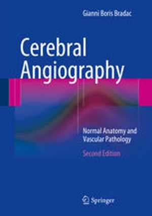 [PDF] دانلود کتاب Cerebral Angiography - Normal Anatomy And Vascular Pathology, 2nd ed, 2014