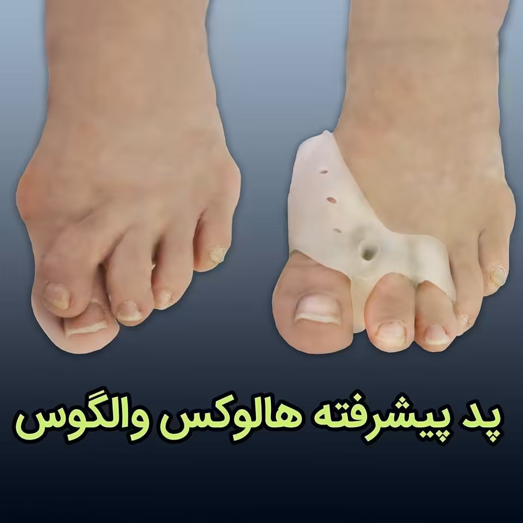 پد طبی پیشرفته  هالموس والگوس