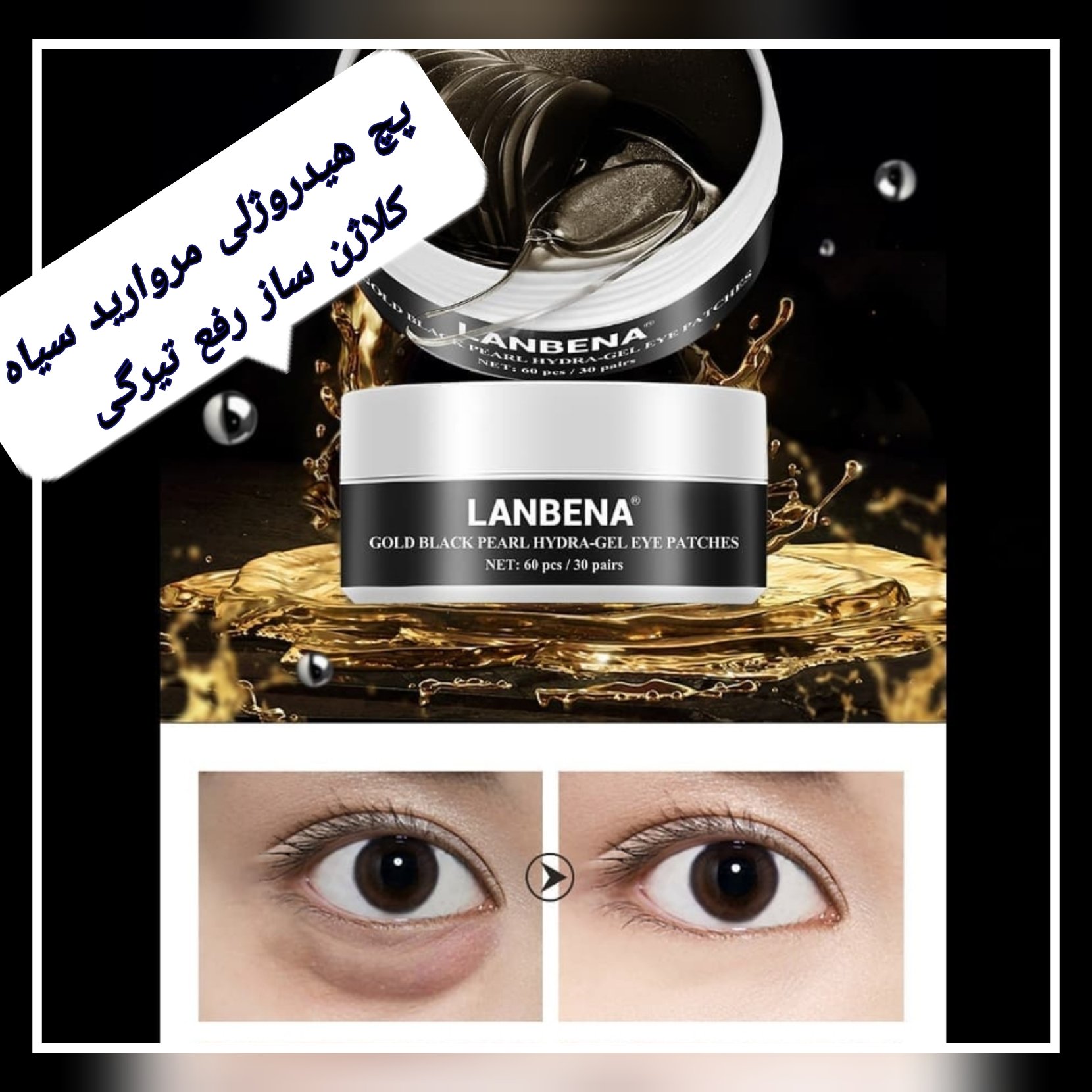 پچ هیدروژلی مروارید سیاه لانبنا