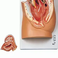 مدل (مولاژ) لگن خاصره زن