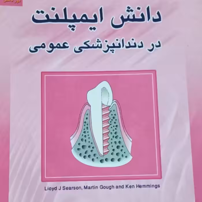 کتاب آموزش ایمپلنت دندانپزشکی عمومی