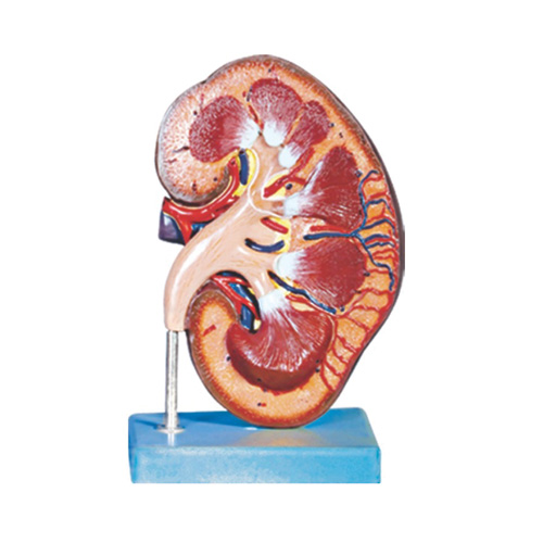 مولاژ کلیه ایستاده