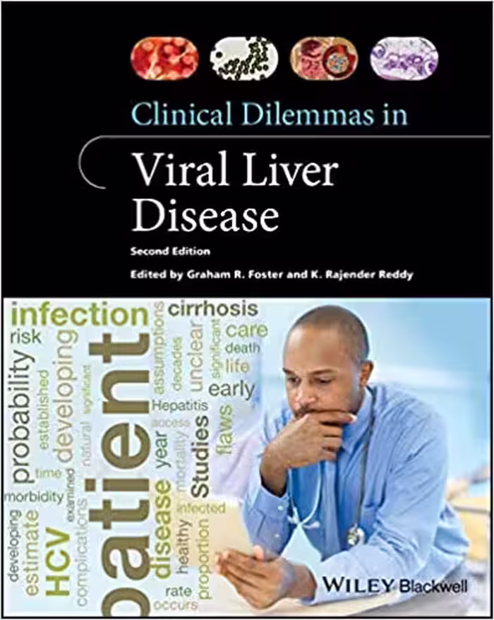 󾕇 دانلود کتاب Clinical Dilemmas In Viral Liver Disease, 2nd ed, 2020 - دانلود کتاب های دانشگاهی