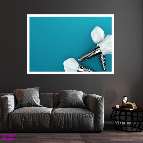 تابلو بکلیت طرح ایمپلنت و دندانپزشکی مدل قاب شاسی W-s9453