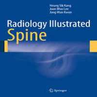 [PDF] دانلود کتاب Radiology Illustrated - Spine, 2014