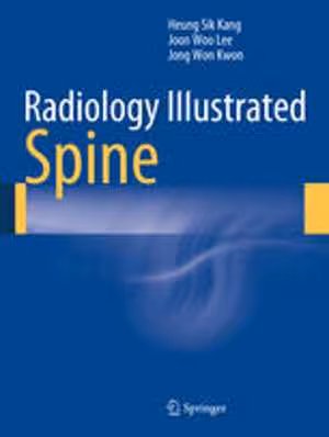 [PDF] دانلود کتاب Radiology Illustrated - Spine, 2014