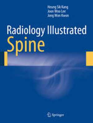 [PDF] دانلود کتاب Radiology Illustrated - Spine, 2014