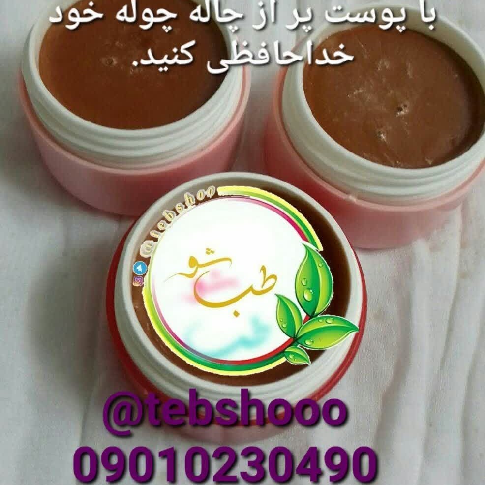 پمادمنافذباز و عمیق تضمینی( رفع چاله های پوستی ،جای جوش عمیق،سالک آبله ) ظرفهای کوچکتر با قیمت مناسبتر موجوده پی وی