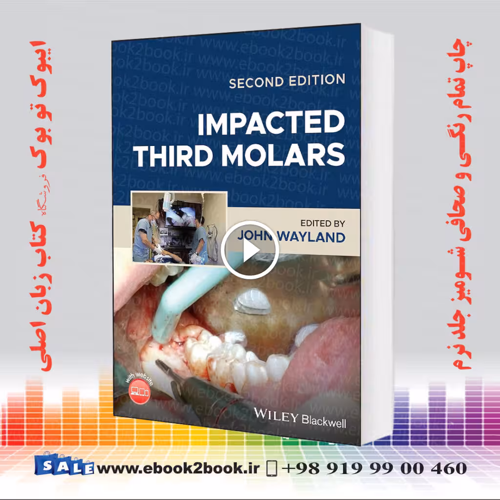 Impacted Third Molars 2nd Edition