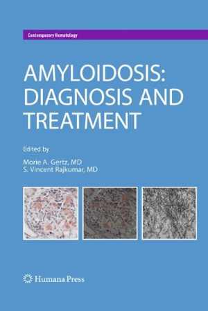 [PDF] دانلود کتاب Amyloidosis - Diagnosis And Treatment, 2010