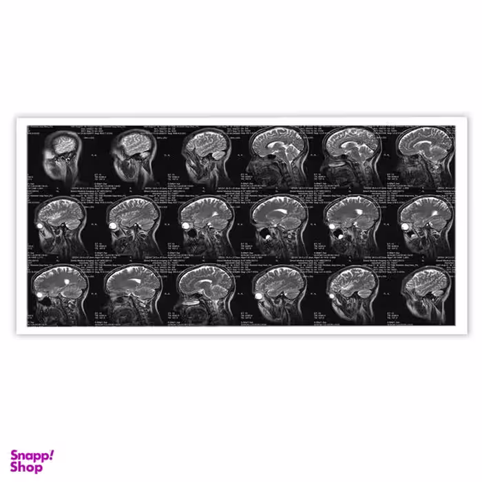 تابلو بکلیت طرح رادیورافی مغز و جمجمه مدل W-10620