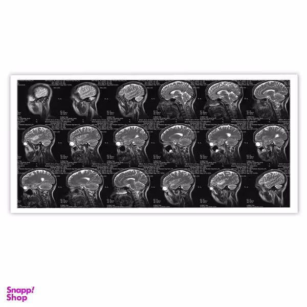 تابلو بکلیت طرح رادیورافی مغز و جمجمه مدل W-10620