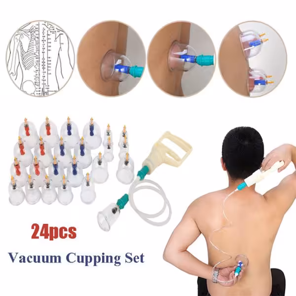 دستگاه حجامت   بادکش طبی بدن 24 لیوان