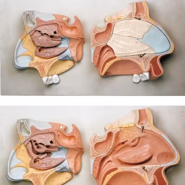 مدل (مولاژ) مقاطع میانی بینی 

