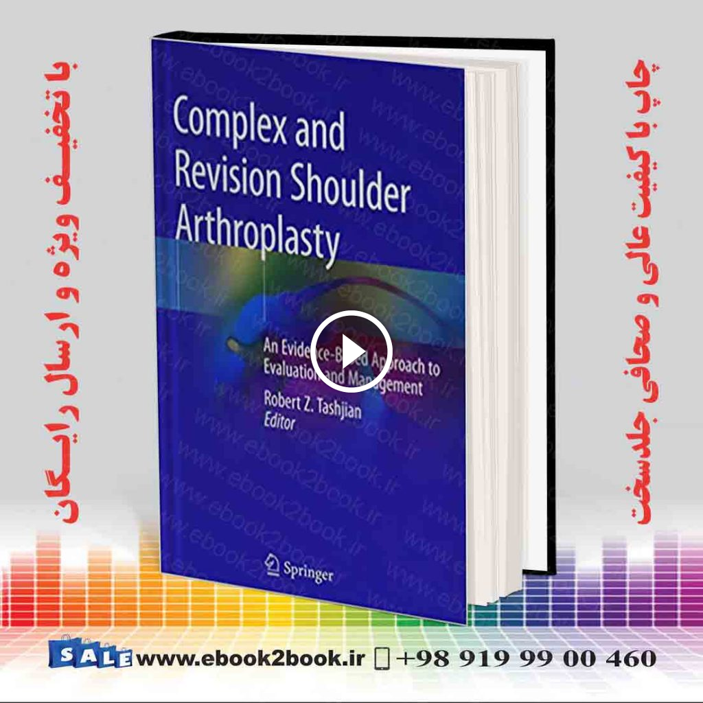 Complex and Revision Shoulder Arthroplasty