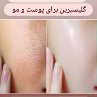 گلیسیرین 250سیسی مخصوص پوست و مو نرم کننده بازرگانی دکتر زندی