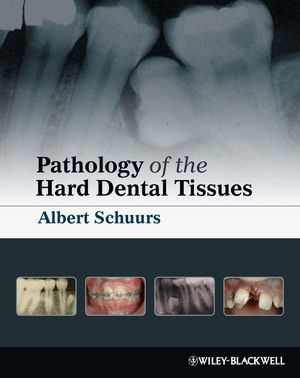 [PDF] دانلود کتاب Pathology Of The Hard Dental Tissues, 2012