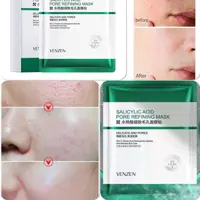 ماسک ورقه ای ضد لک و جوش سالیسیلیک اسید ونزن