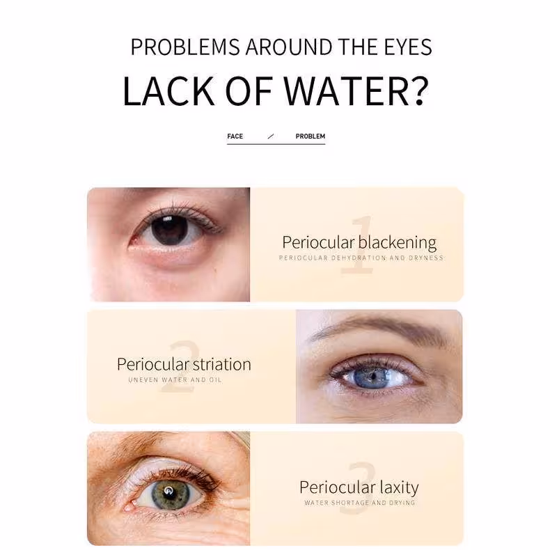 کرم دور چشم بایو آکوا مدل Rice Raw Pulp حجم 20 میلی لیتر