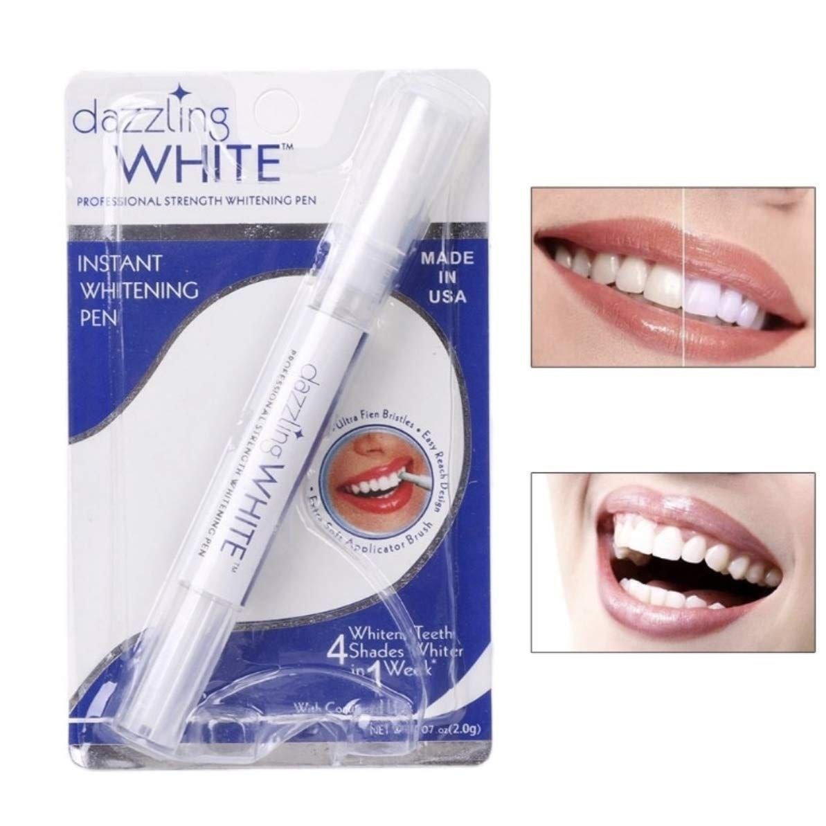 قلم سفید کننده دندان دزلینگ وایت
Dazzling white teeth whitening pen