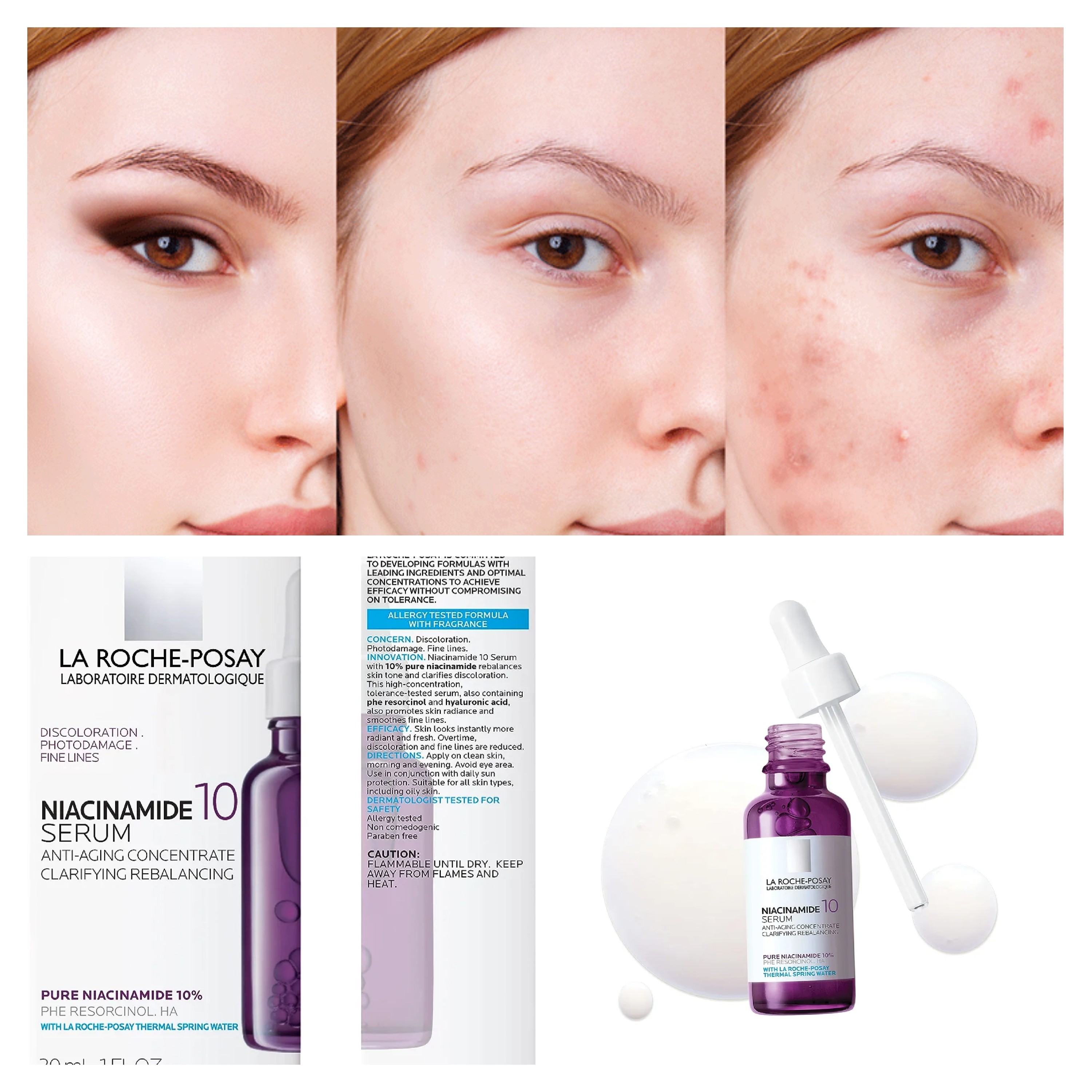 سرم لاروش پوزای نیاسینامید laroche posay niacinamide 10 (فرانسه) 30میل(اورجینال)