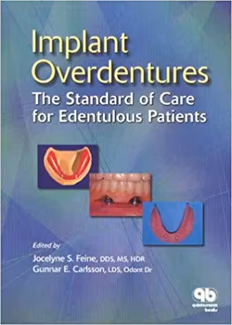 󾕇 دانلود کتاب Implant Overdentures The Standard Of Care For Edentulous Patients, 2003 - دانلود کتاب های دانشگاهی