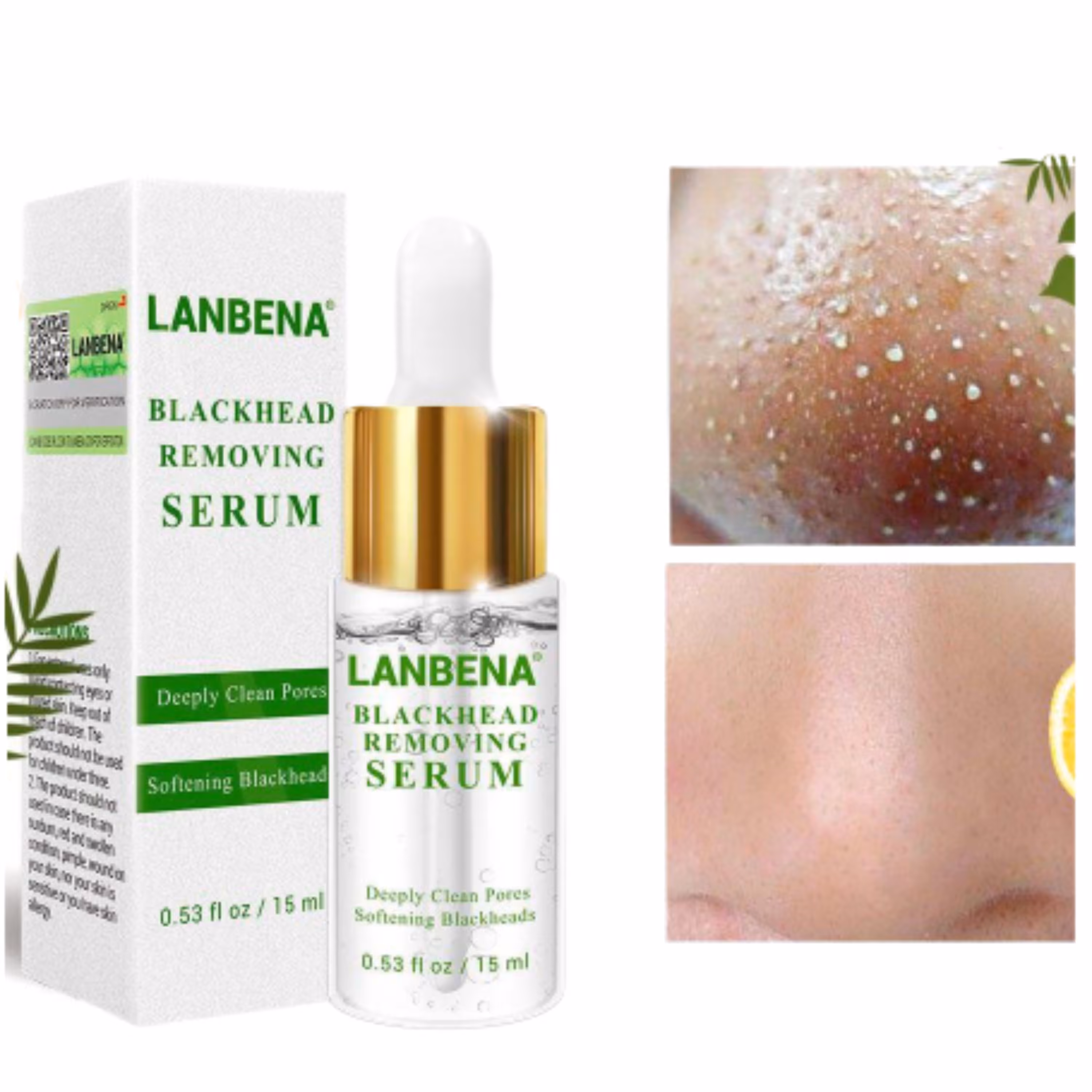 سرم از بین برنده جوش های سرسیاه لانبنا حجم 15 میلی لیتر