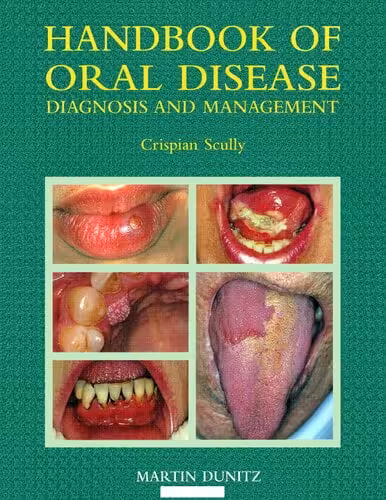 󾕇 دانلود کتاب Handbook Of Oral Disease - Diagnosis And Management, 1999 - دانلود کتاب های دانشگاهی