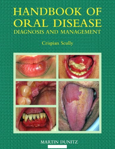  دانلود کتاب Handbook Of Oral Disease - Diagnosis And Management, 1999 - دانلود کتاب های دانشگاهی