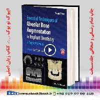 Essential Techniques of Alveolar Bone Augmentation in Implant Dentistry 2nd Edition