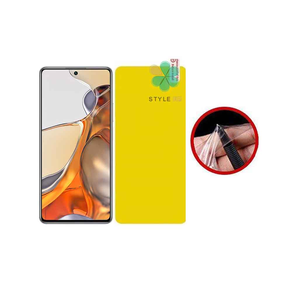محافظ صفحه نانو گوشی شیائومی Xiaomi 11T Pro