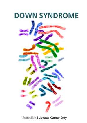 [PDF] دانلود کتاب Control Of Dental Biofilm And Oral Health Maintenance In Patients With Down Syndrome, 2013