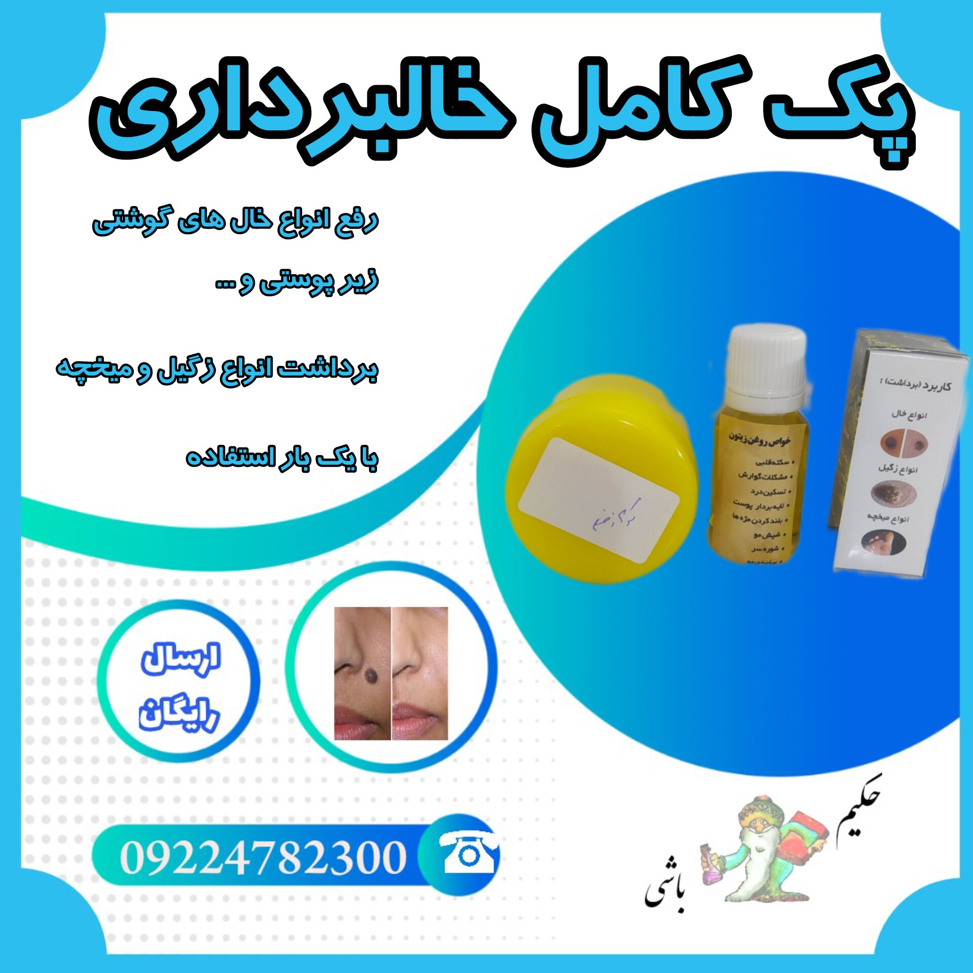 خالبرداری پک کامل ( برداشت انواع خال ، زگیل ، میخچه ) فقط با یک بار استفاده 