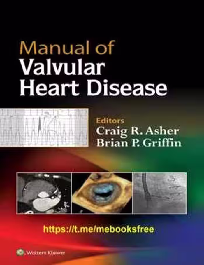 [PDF] دانلود کتاب Manual Of Valvular Heart Disease, 2017