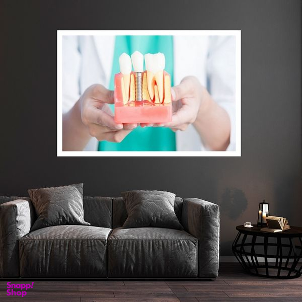 تابلو بکلیت طرح ایمپلنت و دندانپزشکی مدل قاب شاسی W-s10146