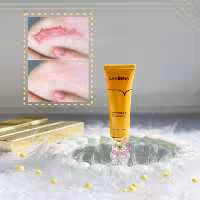 ژل کرم اسکار  و جای جوش لانبنا ترمیم کننده پوست | بیوتلا