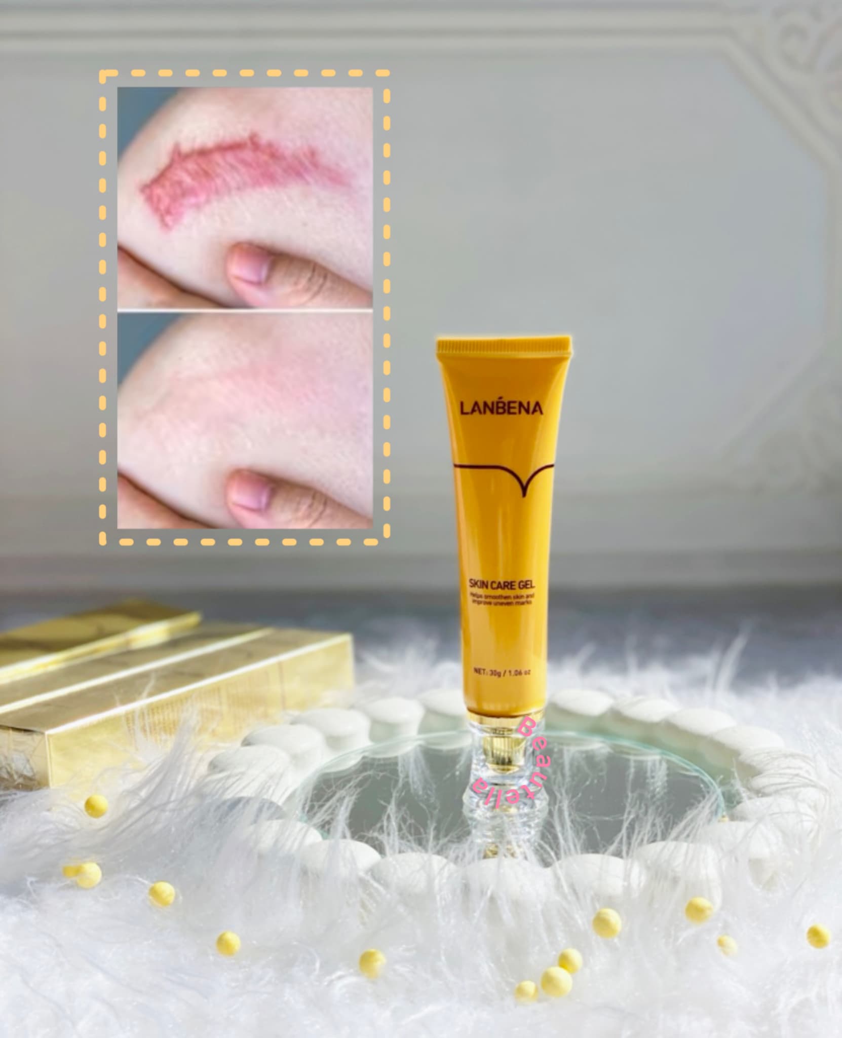 ژل کرم اسکار و جای جوش لانبنا ترمیم کننده پوست | بیوتلا