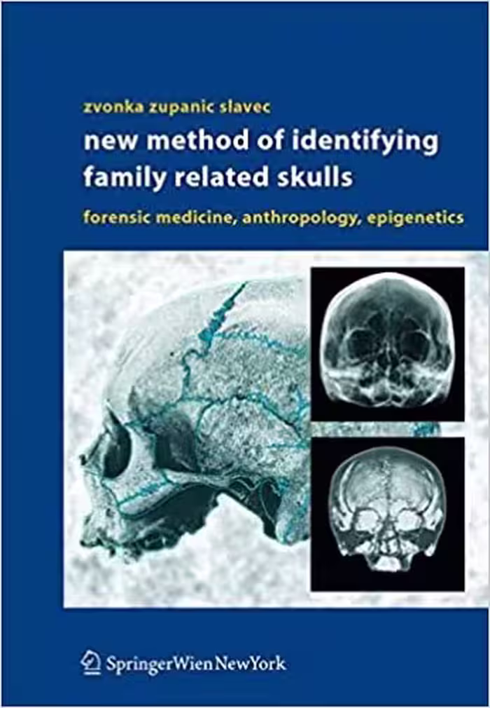 󾕇 دانلود کتاب New Method Of Identifying Family Related Skulls - Forensic Medicine, Anthropology, Epigenetics, 2004 - دانلود کتاب های دانشگاهی